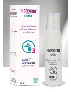 Rigenoma Spray per mucose infiammate